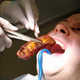 Image for article titled Breakthrough Procedure Allows Surgeons To Transplant Pig Rib Directly Into Human Mouth